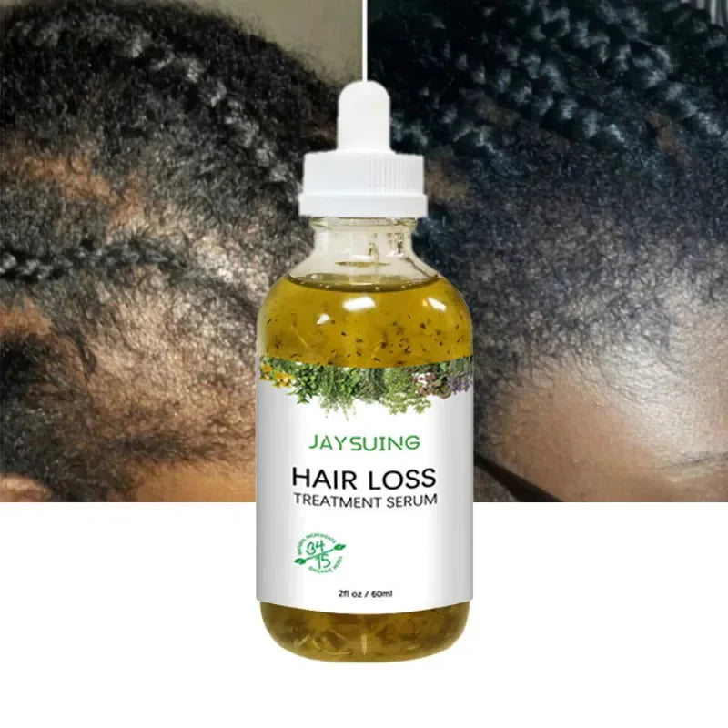 Rosemary Hair Growth Serum Anti Hair Loss Prevent Baldness Hair Care Essential Oil Scalp Treatment Beauty Health Care Men Women